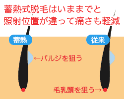 蓄熱式と従来の照射位置の違い